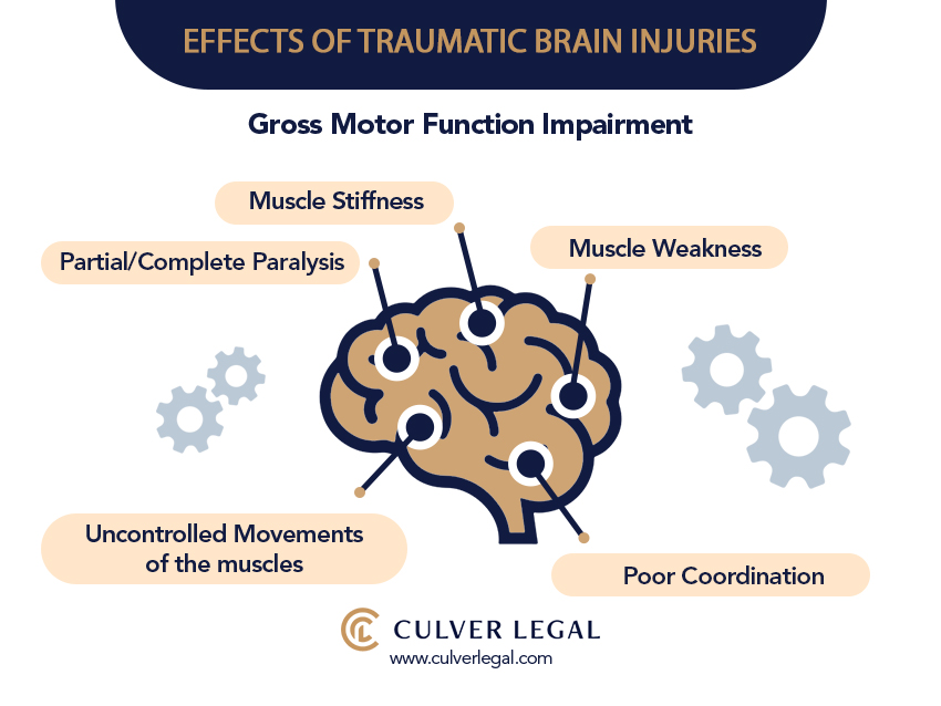 Brain Injury Lawyer in Riverside