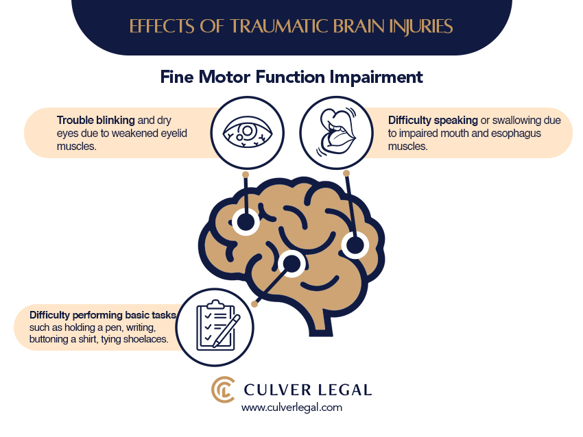 Brain Injury Lawyer in Huntington Park near me