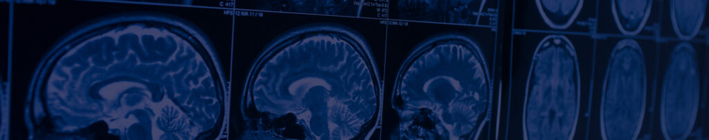 Traumatic Brain Injuries (TBI)